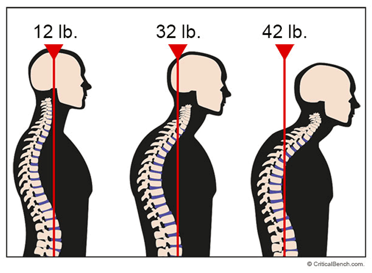 Text Neck